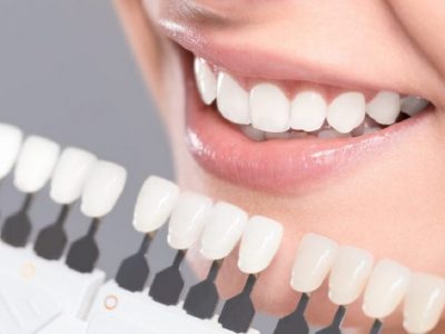 روش های موثر برای سفیدی دندان با مواد طبیعی