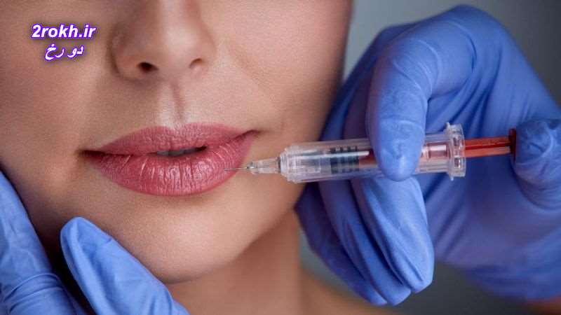 چطور از ژل لب تزریق شده مراقبت کنیم؟